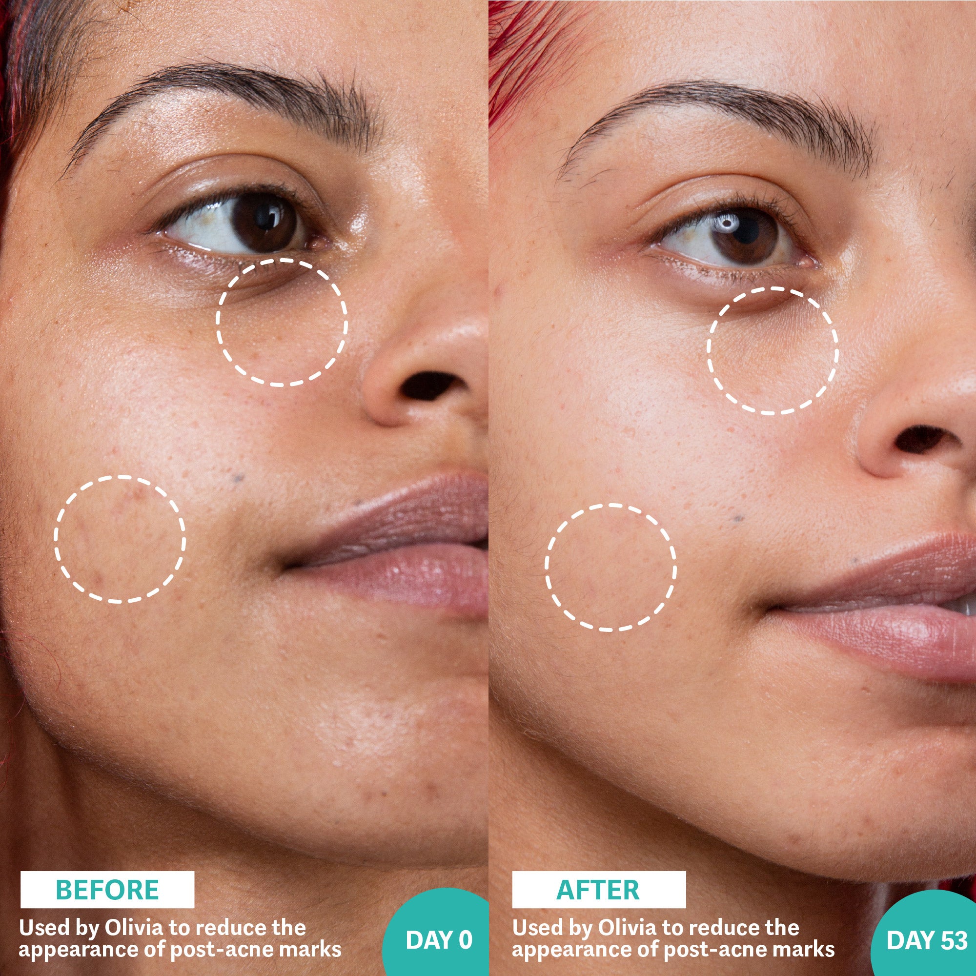 Before and After shot of woman using retinol & Rainbow algae serum